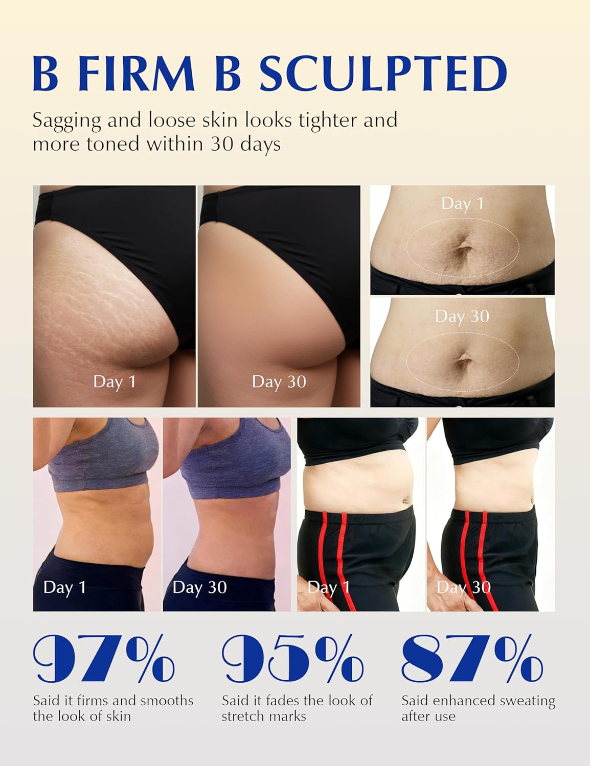 Kandora Skin Tightening Cellulite Cream for Body